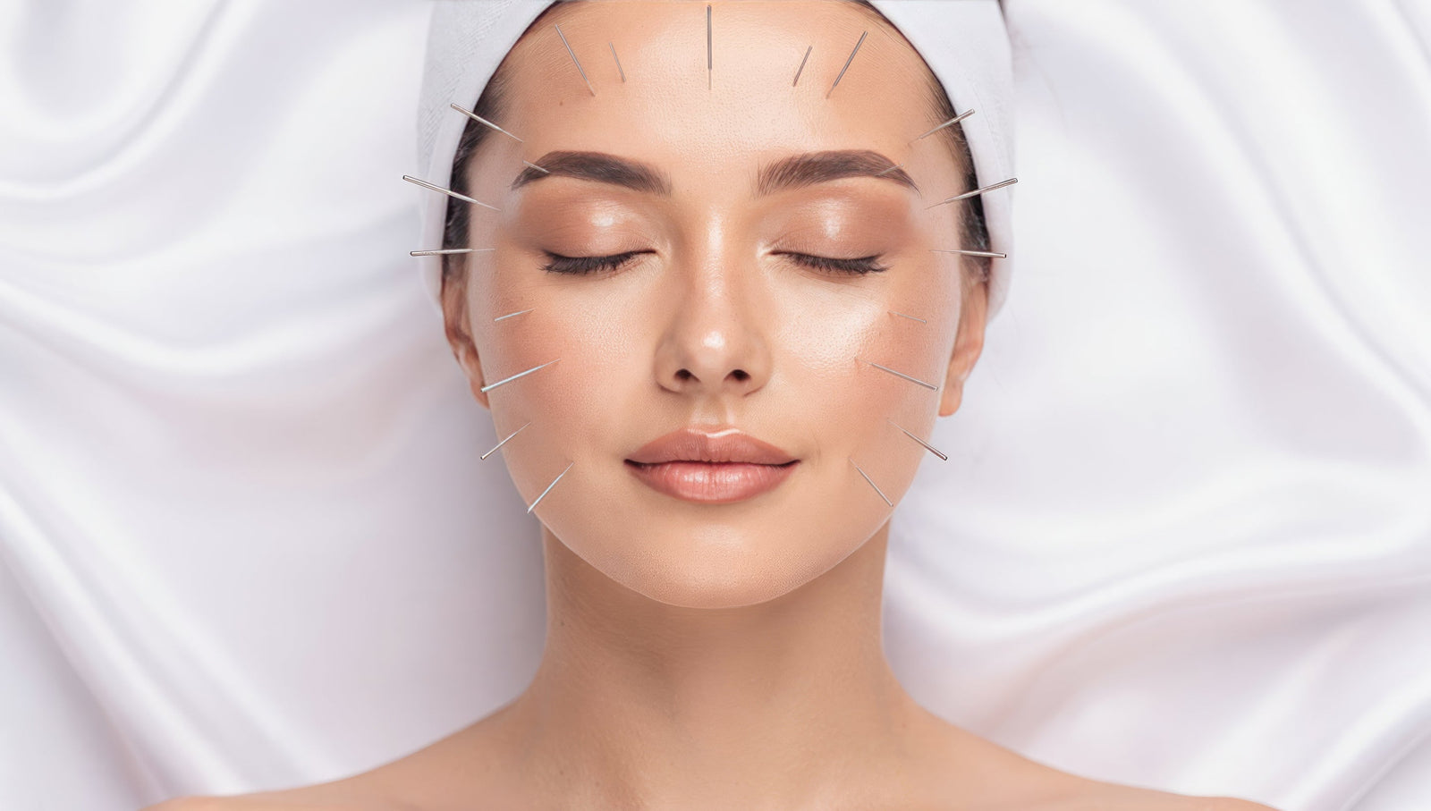 A woman resting with her eyes closed during a calm acupuncture treatment