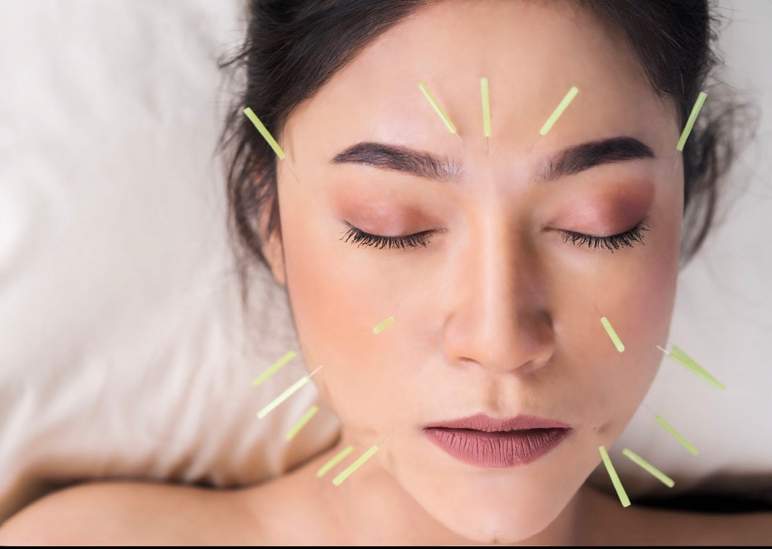 A woman at rest during a full body acupuncture treatment